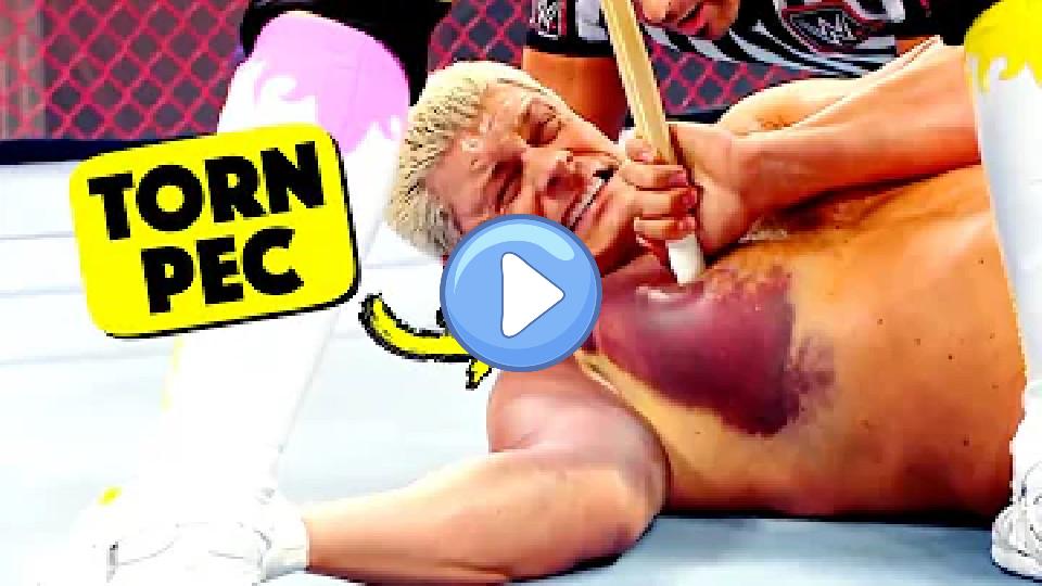 Play video: Doctor Reacts to Painful WWE Injuries Video thumb: Doctor Reacts to Painful WWE Injuries