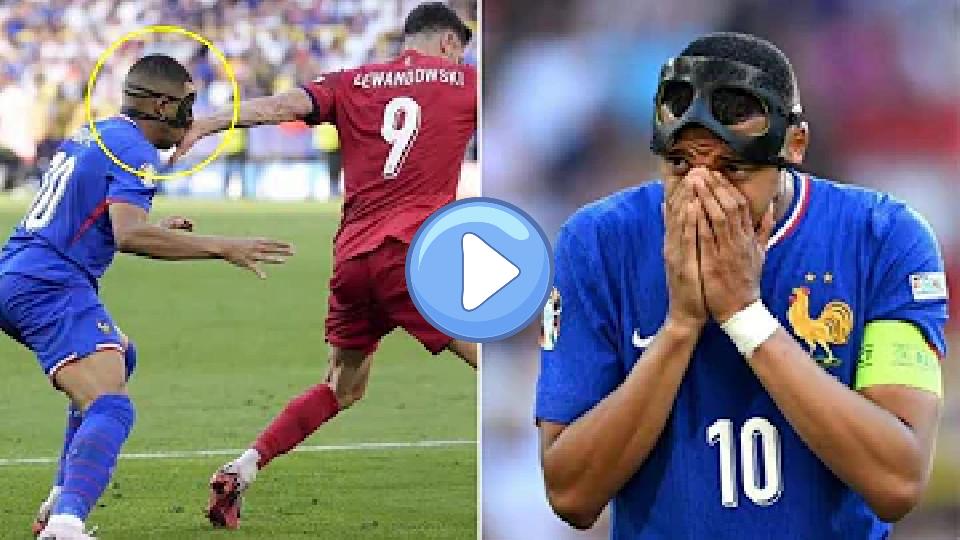 Play video: Mbappe upset after Lewandowski hit his broken nose Video thumb: Mbappe upset after Lewandowski hit his broken nose