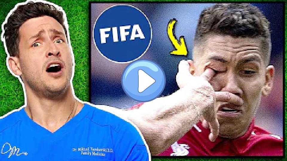 Play video: Doctor Reacts to Intense Soccer Injuries Video thumb: Doctor Reacts to Intense Soccer Injuries