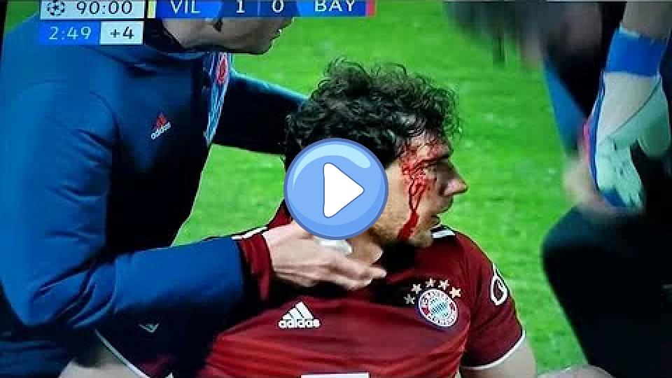 Play video: Goretzka elbowed by Pau Torres vs Villarreal Video thumb: Goretzka elbowed by Pau Torres vs Villarreal