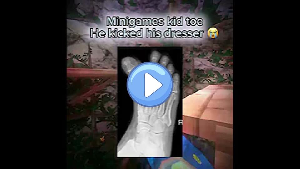 Play video: ๐ Worst Gorilla Tag Injuries ๐ Video thumb: ๐ Worst Gorilla Tag Injuries ๐