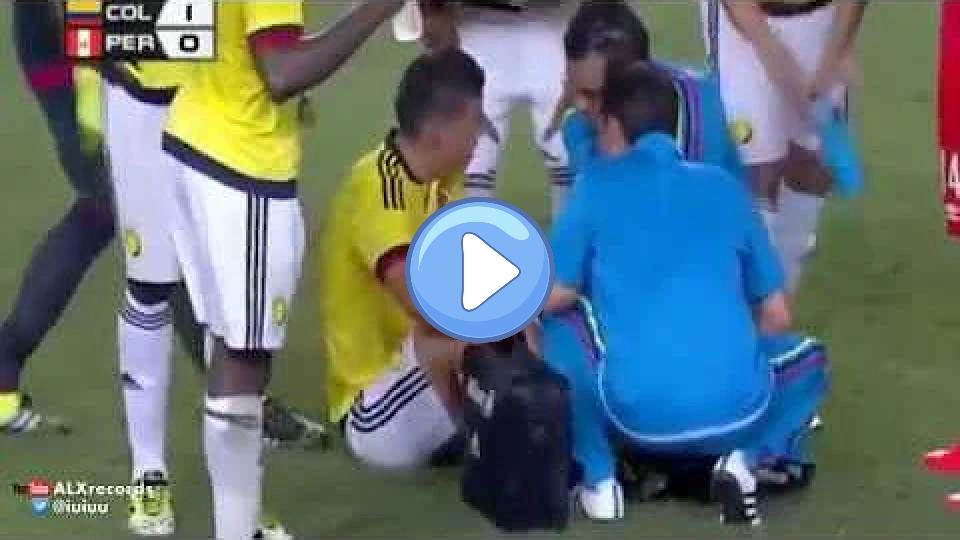 Play video: James Rodriguez injury during the Colombia vs. Peru match in 2015. Video thumb: James Rodriguez injury during the Colombia vs. Peru match in 2015.
