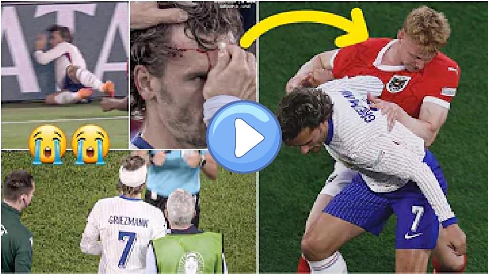 Play video: 🇫🇷 France's Antoine Griezmann bleeding after painfully colliding with advertising board vs Austria Video thumb: 🇫🇷 France's Antoine Griezmann bleeding after painfully colliding with advertising board vs Austria