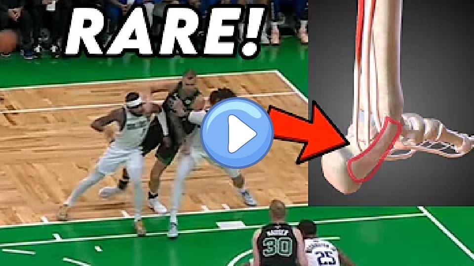 Play video: Porzingis Has an Injury Nobody’s Heard of and Luka Doncic Needs Pain Shots - Doctor Explains Video thumb: Porzingis Has an Injury Nobody’s Heard of and Luka Doncic Needs Pain Shots - Doctor Explains