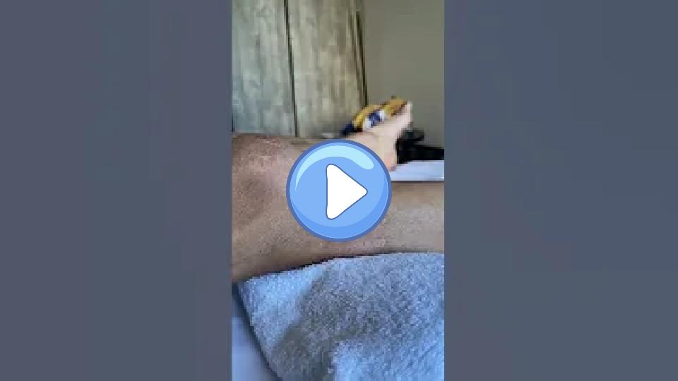 Play video: Rigo's injuries in the Tour de France Video thumb: Rigo's injuries in the Tour de France