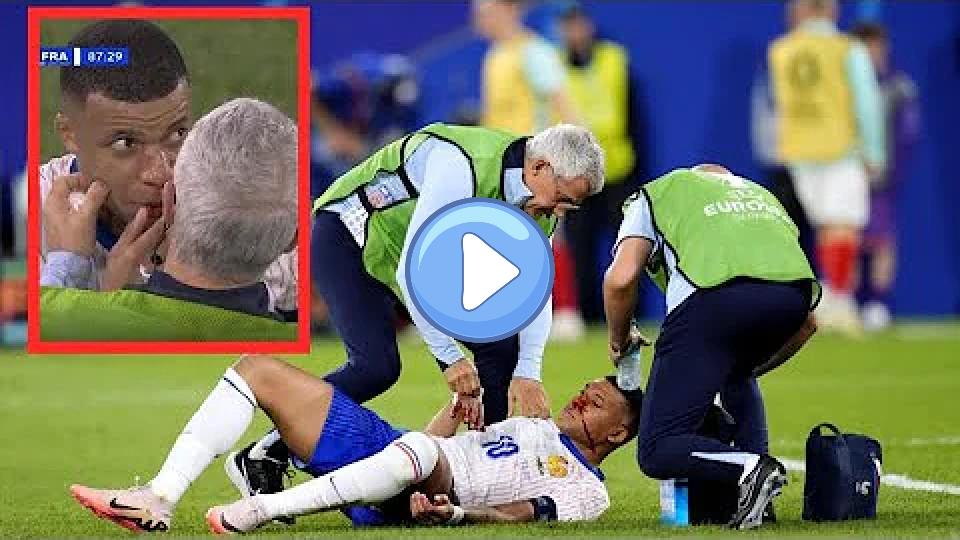 Play video: Kylian Mbappe's nose injury vs. Austria Video thumb: Kylian Mbappe's nose injury vs. Austria