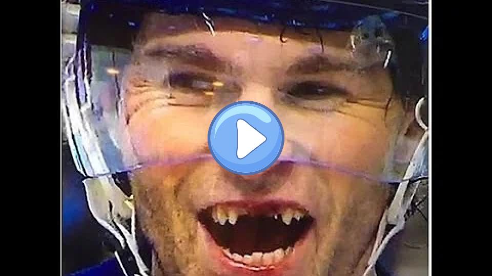 Video thumb: Tooth Injury - Jaromír Jágr - December 23, 2015