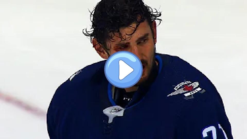 Play video: Jets' Hellebuyck cut open after Morrissey's stick accidentally clips him. Video thumb: Jets' Hellebuyck cut open after Morrissey's stick accidentally clips him.