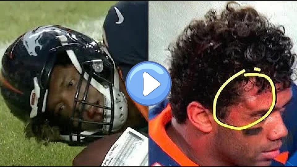 Play video: Russell Wilson Suffers Scary Injury, Sustains Concussion 🚑 Video thumb: Russell Wilson Suffers Scary Injury, Sustains Concussion 🚑