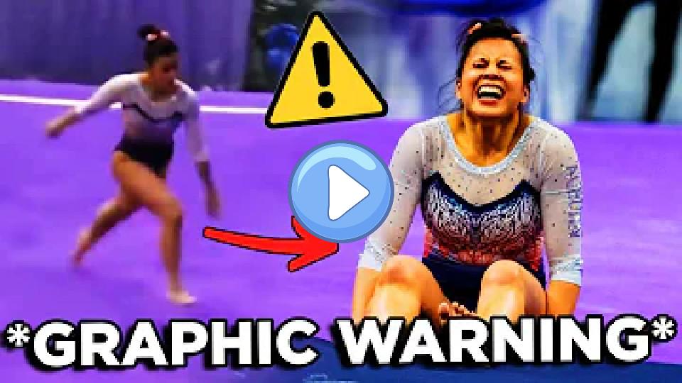 Play video: 16 Most Devastating Injuries in Gymnastics Video thumb: 16 Most Devastating Injuries in Gymnastics