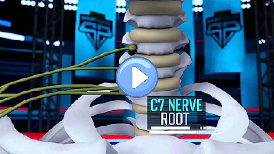 Video thumb: Sports Science: Peyton Manning's Neck Injury