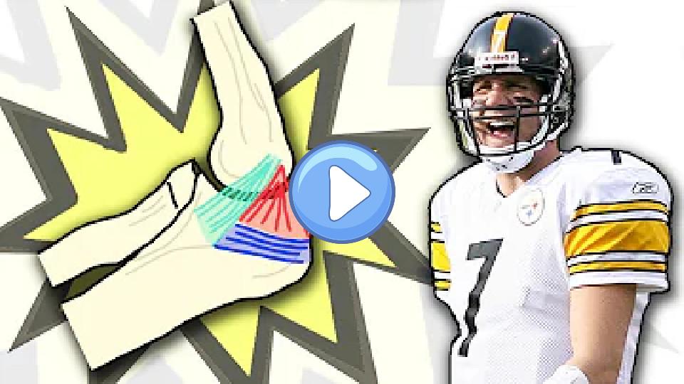 Play video: Doctor Reviews Ben Roethlisberger's Season-Ending Elbow Injury Video thumb: Doctor Reviews Ben Roethlisberger's Season-Ending Elbow Injury