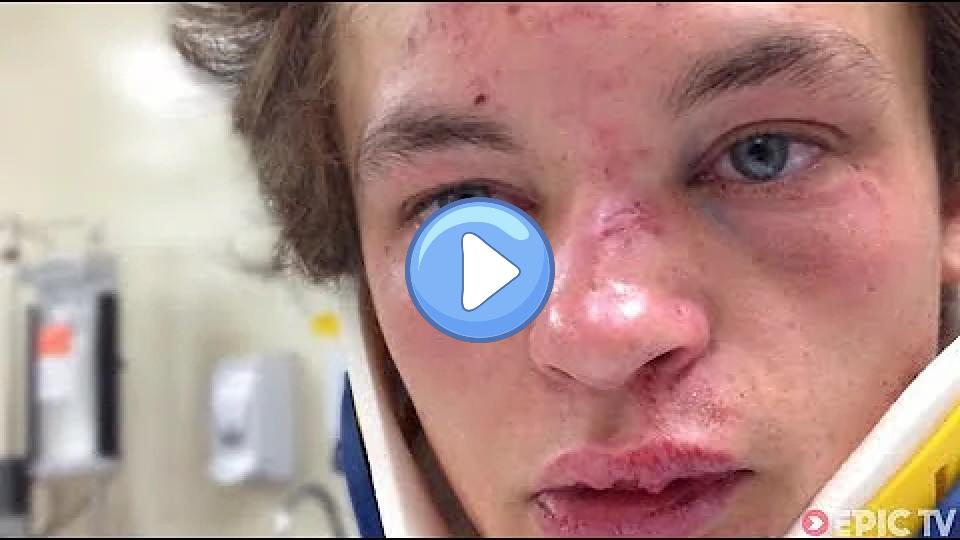Play video: MTB Head Injury at Red Bull Joyride, Recovery | Brayden Barrett-Hay: Regaining Psyche, Ep. 1 Video thumb: MTB Head Injury at Red Bull Joyride, Recovery | Brayden Barrett-Hay: Regaining Psyche, Ep. 1