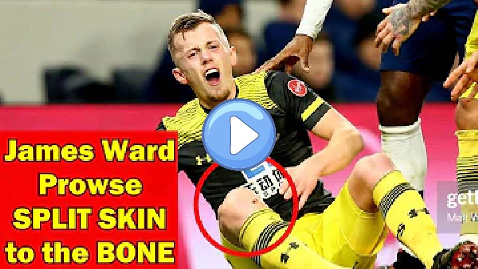 Play video: James Ward-Prowse suffers bone injury in Tottenham vs Southampton match. Video thumb: James Ward-Prowse suffers bone injury in Tottenham vs Southampton match.