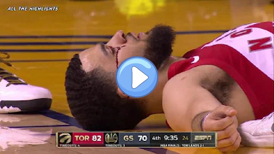 Play video: Fred VanVleet Injury Moments | NBA Finals Game 4 | 2019 Playoffs Video thumb: Fred VanVleet Injury Moments | NBA Finals Game 4 | 2019 Playoffs