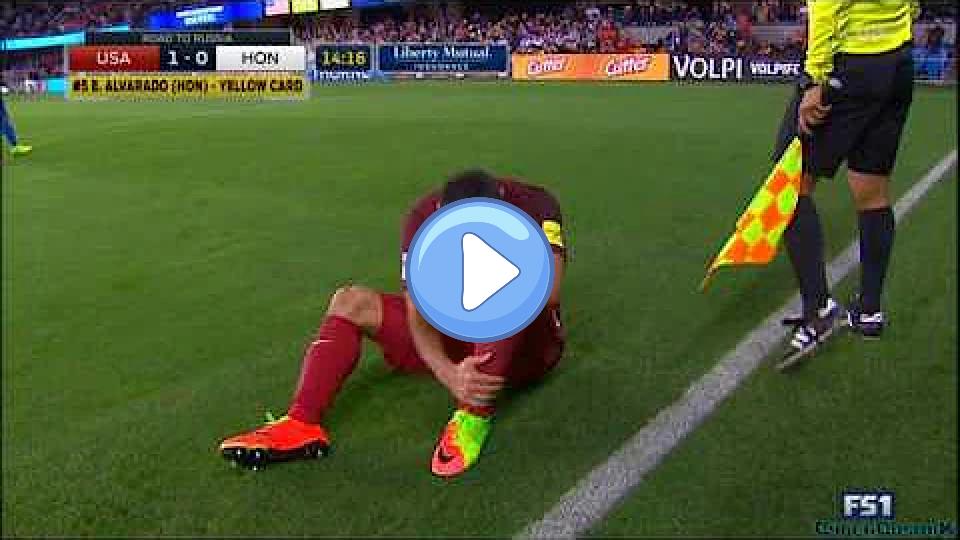Play video: Sebastian Lletget injured by Ever Alvarado on March 24, 2017, during the CONCACAF Hex Qualifier between Honduras and USA. Video thumb: Sebastian Lletget injured by Ever Alvarado on March 24, 2017, during the CONCACAF Hex Qualifier between Honduras and USA.