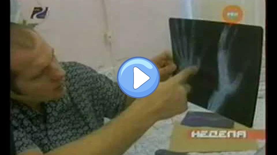 Play video: Fedor meets Wanderlei Silva. Old hand injury. You don't mess with Fedor in training. Video thumb: Fedor meets Wanderlei Silva. Old hand injury. You don't mess with Fedor in training.