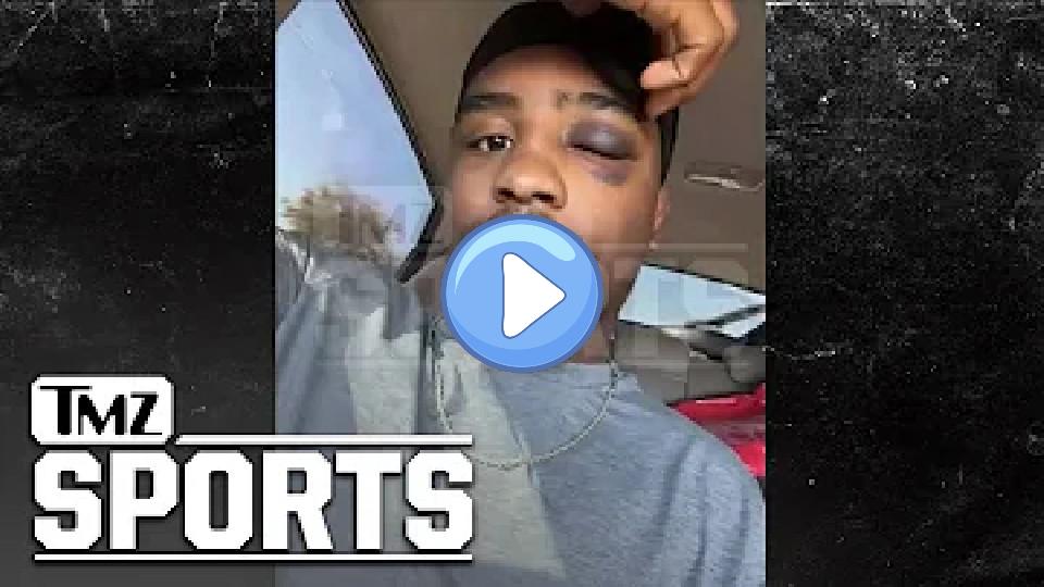 Video thumb: MMA Fighter Mark Martin Hopes to Make a Comeback After Eye Injury During Fight | TMZ Sports