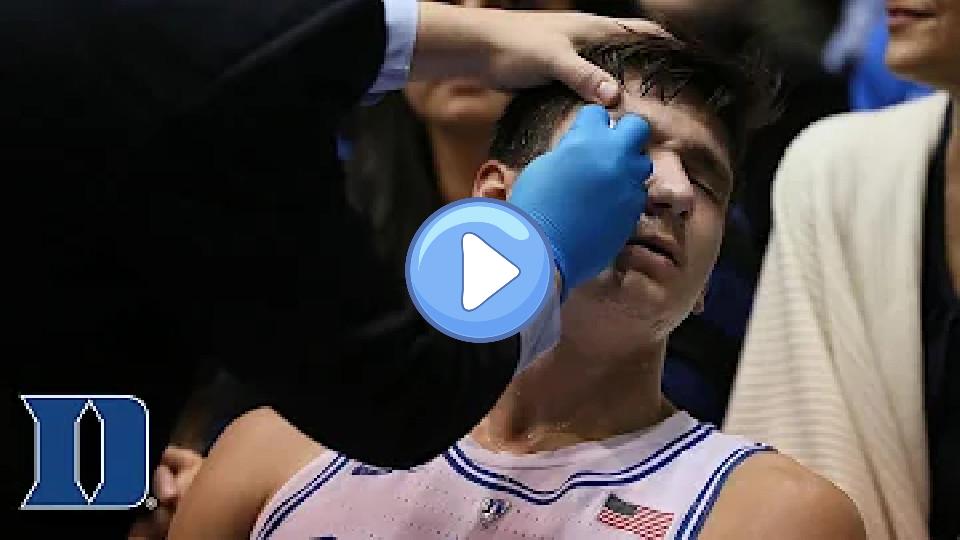 Play video: Grayson Allen Injured Twice Against Miami Video thumb: Grayson Allen Injured Twice Against Miami