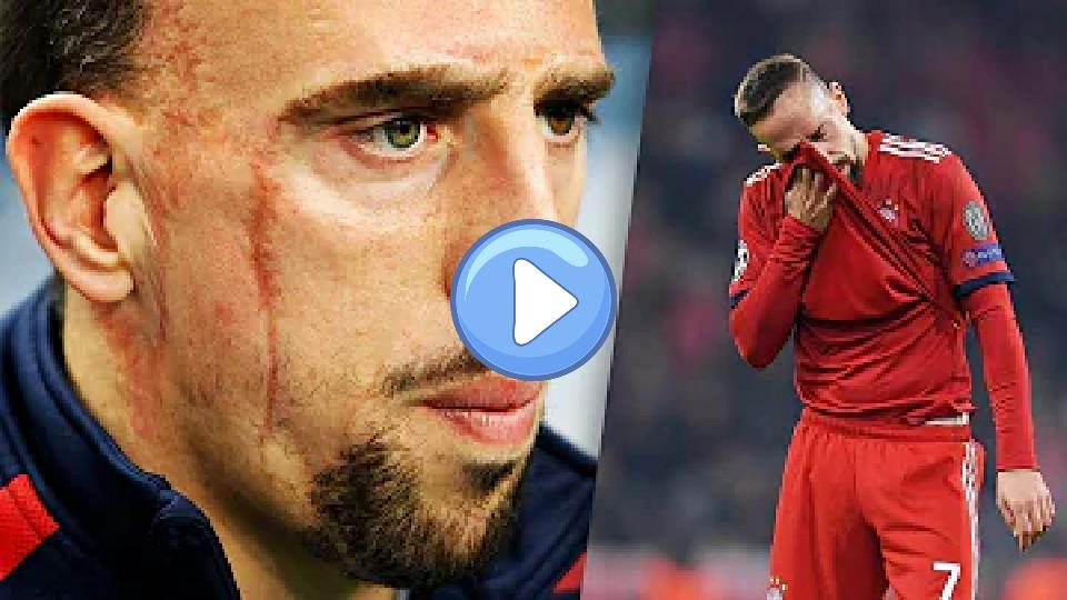 Play video: What's the story behind Franck Ribery's scars? Video thumb: What's the story behind Franck Ribery's scars?