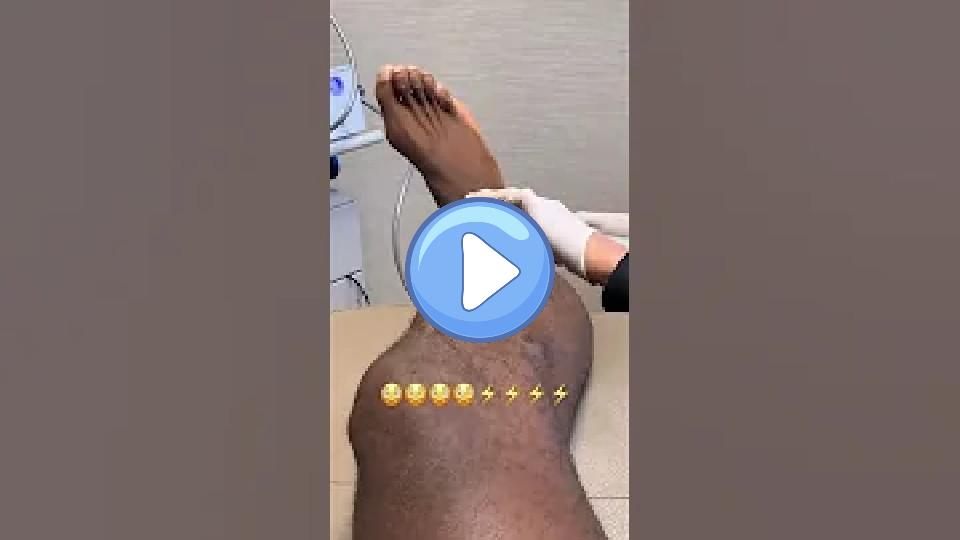 Play video: LeBron James' Ankle Treatment ⚡ | Highlight #Shorts Video thumb: LeBron James' Ankle Treatment ⚡ | Highlight #Shorts