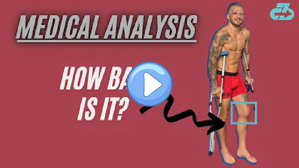 Play video: Expert Explains TJ Dillashaw's Knee Injury, Timeline, and Career Impact Video thumb: Expert Explains TJ Dillashaw's Knee Injury, Timeline, and Career Impact