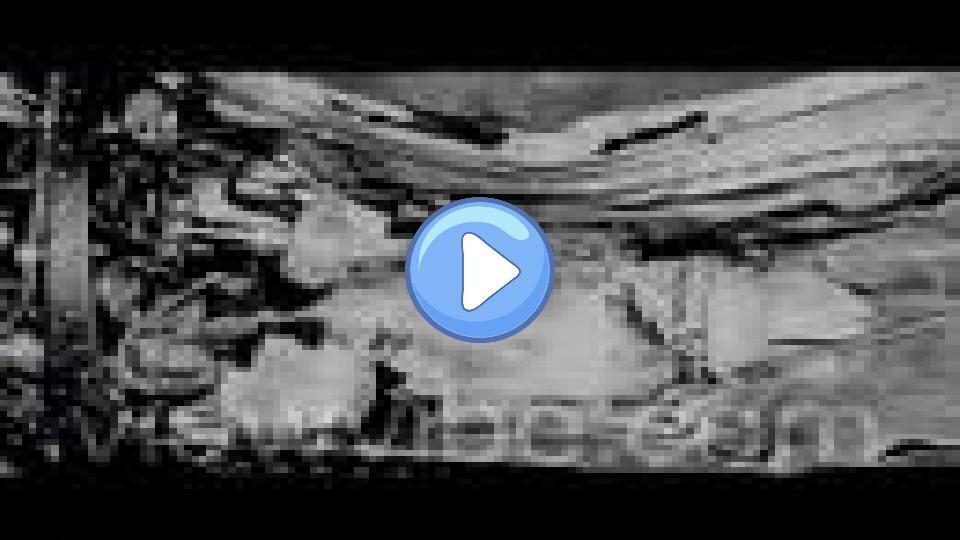 Play video: Jackie Stewart: Oh no, not again... Video thumb: Jackie Stewart: Oh no, not again...