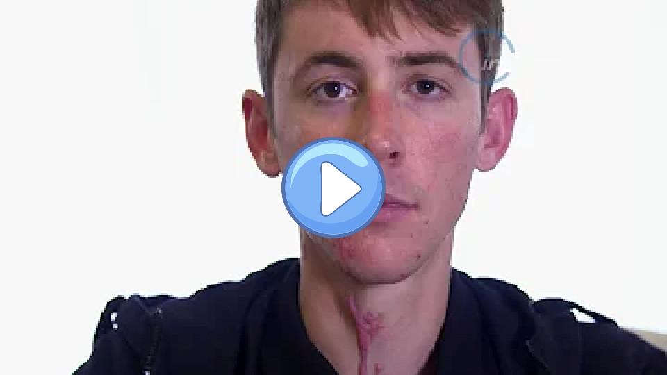 Play video: Chad Haga on the Giant-Alpecin's horrific training crash Video thumb: Chad Haga on the Giant-Alpecin's horrific training crash