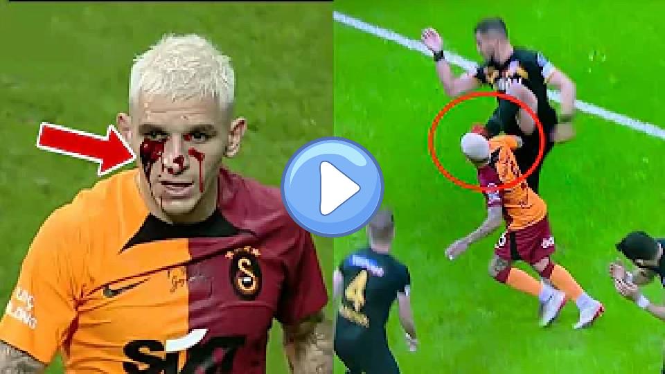 Play video: Lucas Torreira Injury vs Kayserispor Video thumb: Lucas Torreira Injury vs Kayserispor