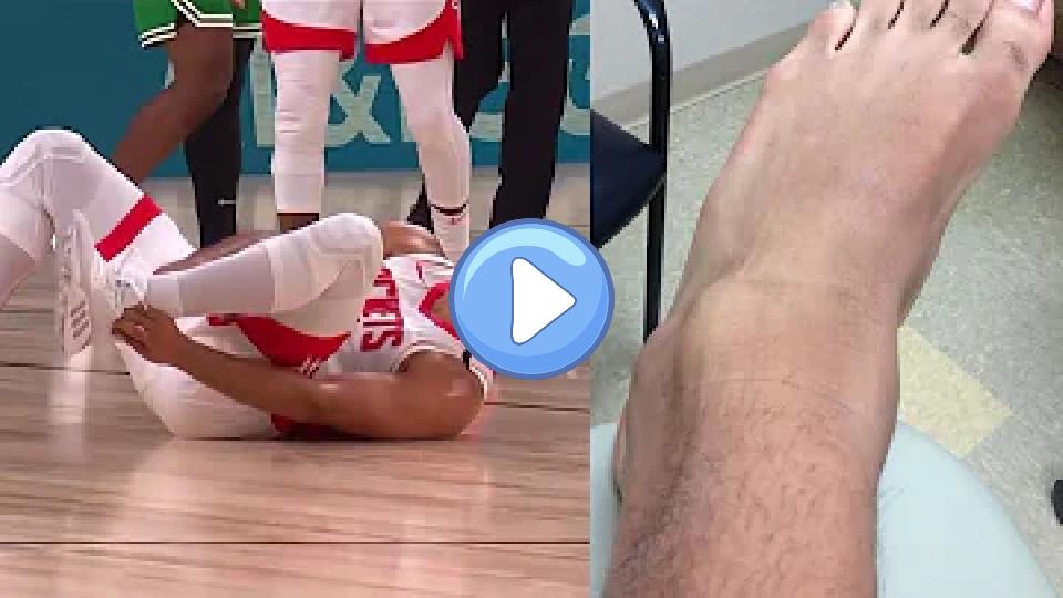 Video thumb: Eric Gordon Injured vs. Celtics (Video)