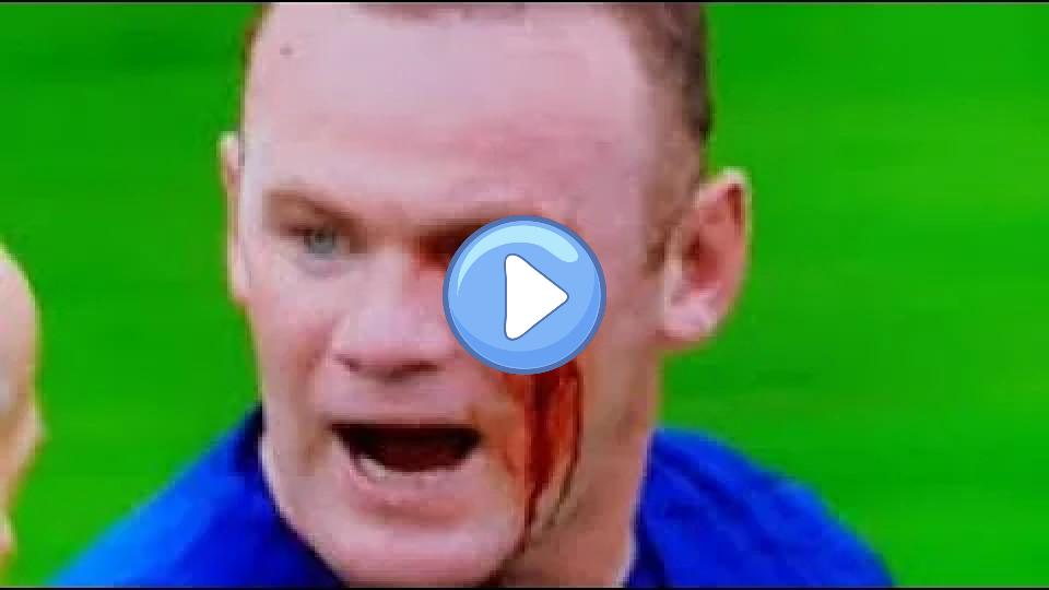 Play video: Wayne Rooney takes a violent elbow to the face - blood spills Video thumb: Wayne Rooney takes a violent elbow to the face - blood spills