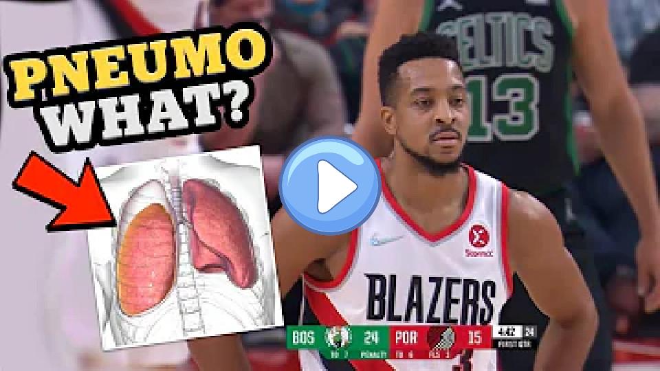 Play video: CJ McCollum Has a Collapsed Lung - Doctor Explains Rare Injury Video thumb: CJ McCollum Has a Collapsed Lung - Doctor Explains Rare Injury