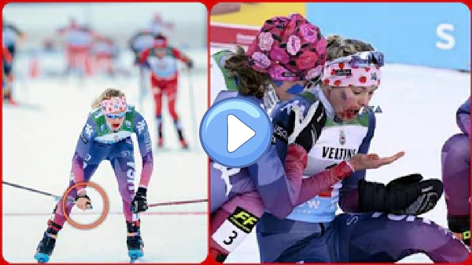 Play video: Jessie Diggins Ruka - Jessie Diggins, bloodied and missing a glove - Jessie Diggins ski accident Video thumb: Jessie Diggins Ruka - Jessie Diggins, bloodied and missing a glove - Jessie Diggins ski accident
