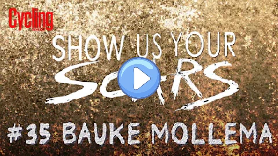 Play video: Show us your scars: Bauke Mollema #35 Video thumb: Show us your scars: Bauke Mollema #35