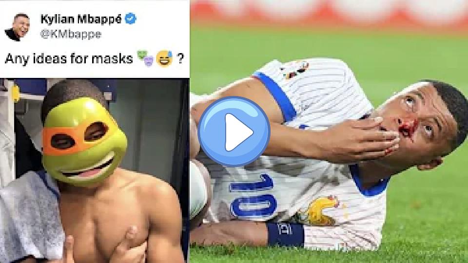 Play video: Epic Reactions to Kylian Mbappe's Broken Nose Video thumb: Epic Reactions to Kylian Mbappe's Broken Nose