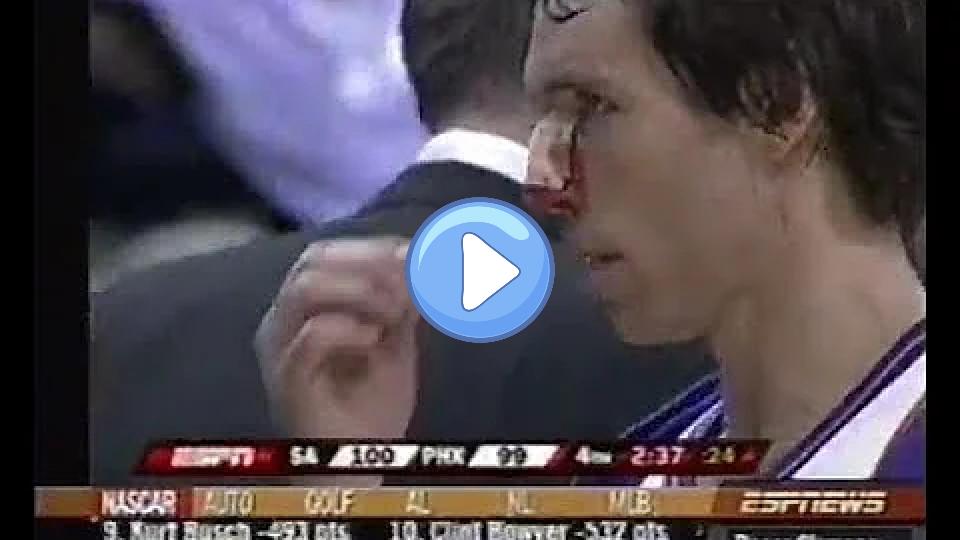 Play video: Steve Nash Suffers Severe Nose Injury (2007 ESPNEWS Coverage) Video thumb: Steve Nash Suffers Severe Nose Injury (2007 ESPNEWS Coverage)