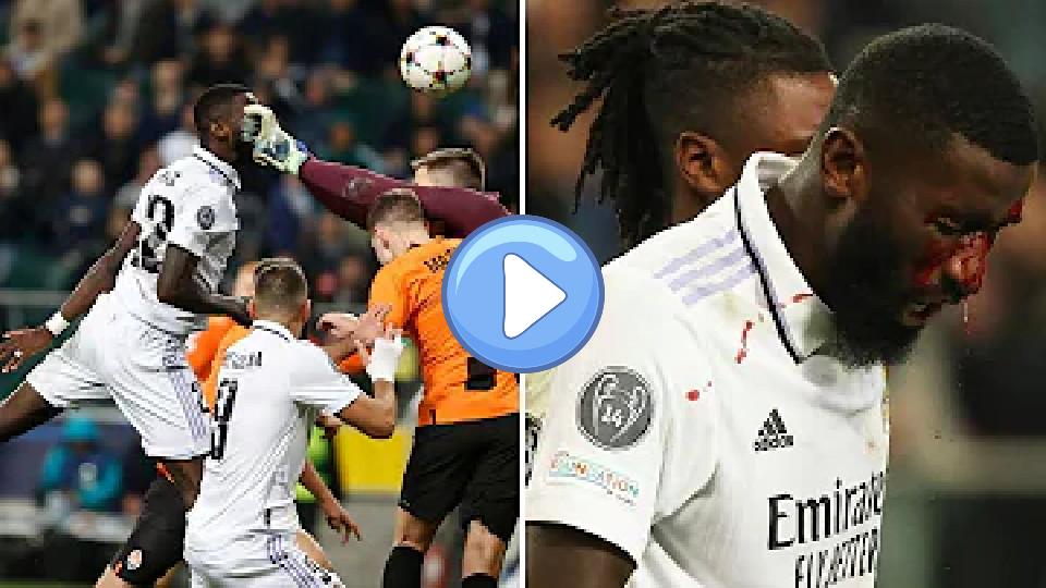 Play video: Antonio Rüdiger's Last-Minute Heroic Goal Against Shakhtar Donetsk (Best Angle) Video thumb: Antonio Rüdiger's Last-Minute Heroic Goal Against Shakhtar Donetsk (Best Angle)