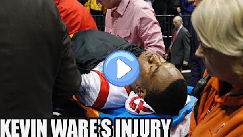Video thumb: Kevin Ware suffered a compound fracture, commonly known as an open fracture, during a basketball game.