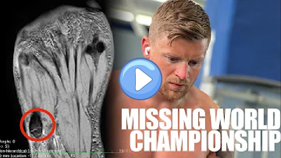 Play video: How I Broke My Foot! Video thumb: How I Broke My Foot!