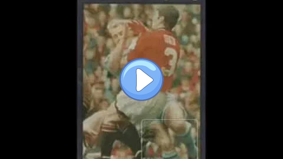Play video: David Busst injury (compound fracture of the tibia and fibula) Video thumb: David Busst injury (compound fracture of the tibia and fibula)
