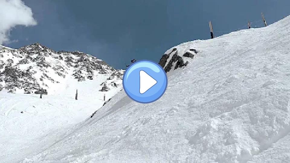Play video: Skiing Injury - Torn ACL and MCL Video thumb: Skiing Injury - Torn ACL and MCL
