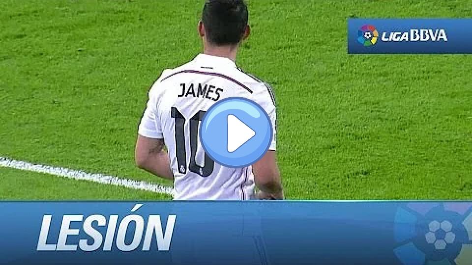 Play video: James Rodríguez's injury Video thumb: James Rodríguez's injury