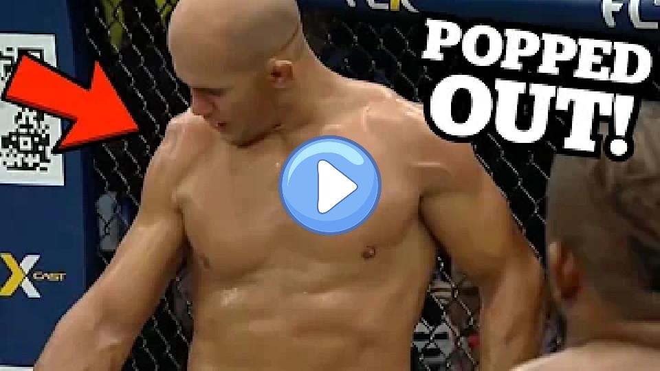 Play video: Junior Dos Santos Dislocates Shoulder While Throwing a Punch - Doctor Explains Video thumb: Junior Dos Santos Dislocates Shoulder While Throwing a Punch - Doctor Explains