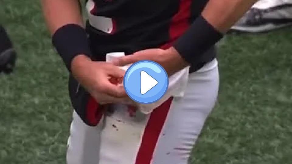 Play video: Matt Ryan’s severe hand injury Video thumb: Matt Ryan’s severe hand injury