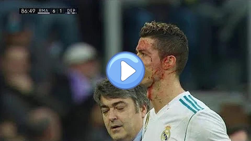 Video thumb: Cristiano Ronaldo Injury: Bleeding Goal - Real Madrid vs Deportivo