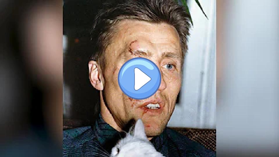 Video thumb: 9 cringe-worthy hockey injuries in 90 seconds