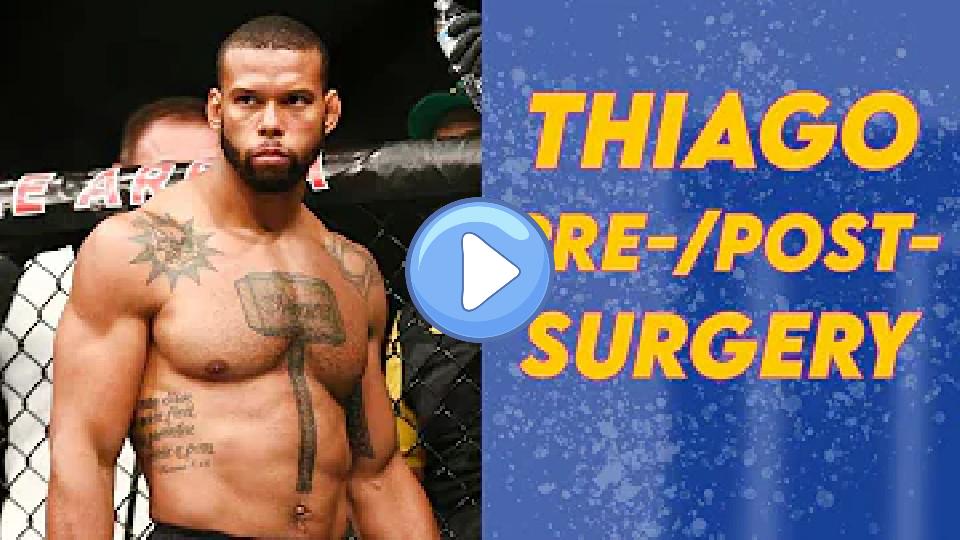 Play video: 3 Minutes of Thiago Santos: Pre-Knee Surgeries vs. Post-Knee Surgeries Video thumb: 3 Minutes of Thiago Santos: Pre-Knee Surgeries vs. Post-Knee Surgeries