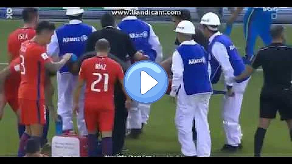 Play video: Horrific Injury: Arturo Vidal vs. Colombia - World Cup Qualification Video thumb: Horrific Injury: Arturo Vidal vs. Colombia - World Cup Qualification