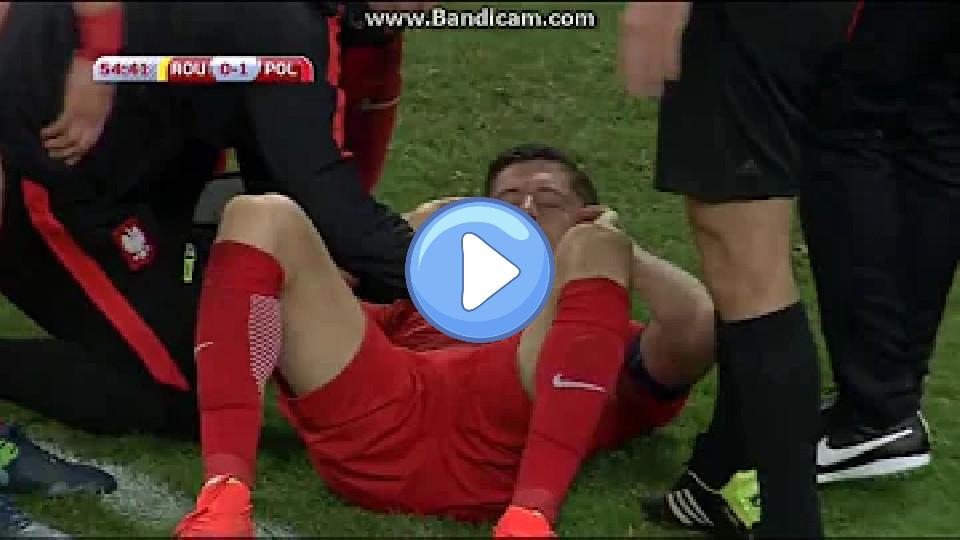 Play video: Robert Lewandowski Attacked with Firecrackers (HD) Video thumb: Robert Lewandowski Attacked with Firecrackers (HD)