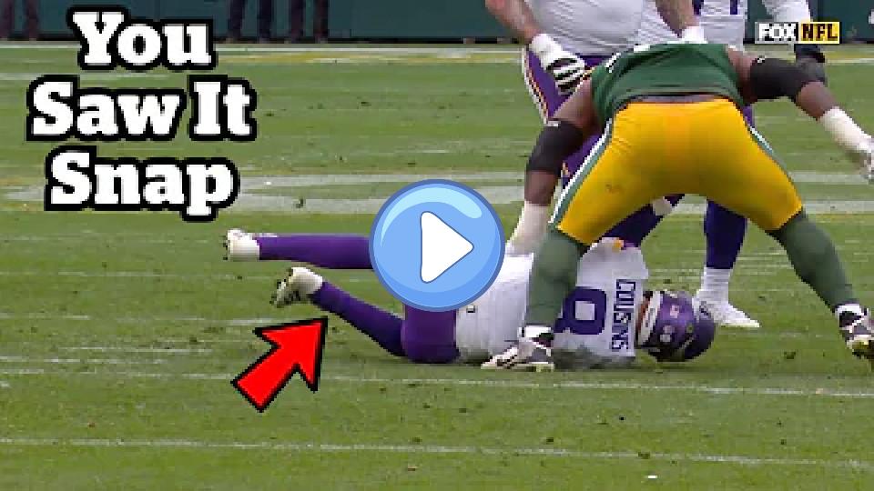 Play video: Kirk Cousins Ruptures His Achilles: Doctor Explains Video thumb: Kirk Cousins Ruptures His Achilles: Doctor Explains